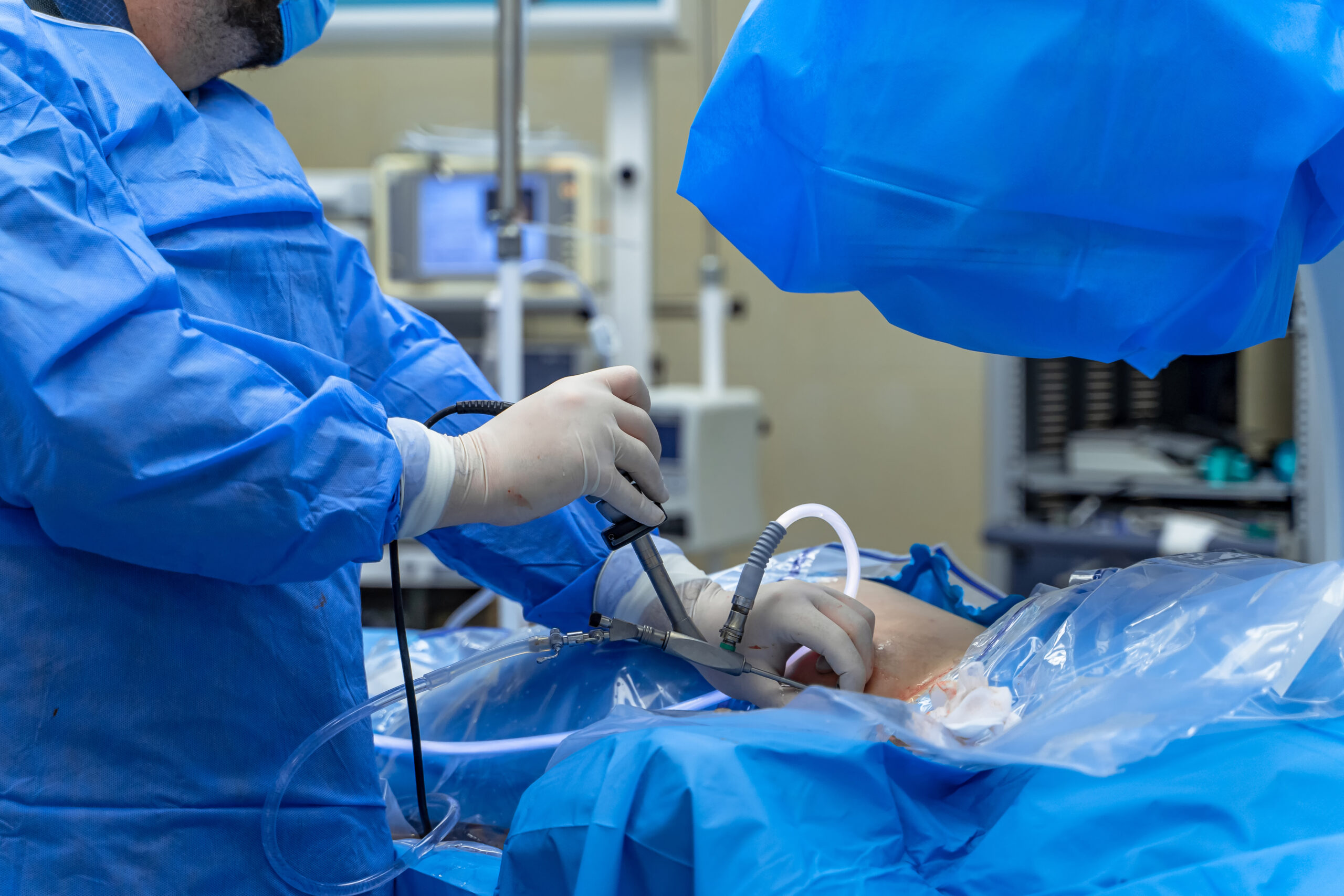 Surgery modern operating equipment. Group of specialists performing operation. Laparoscopic procedure